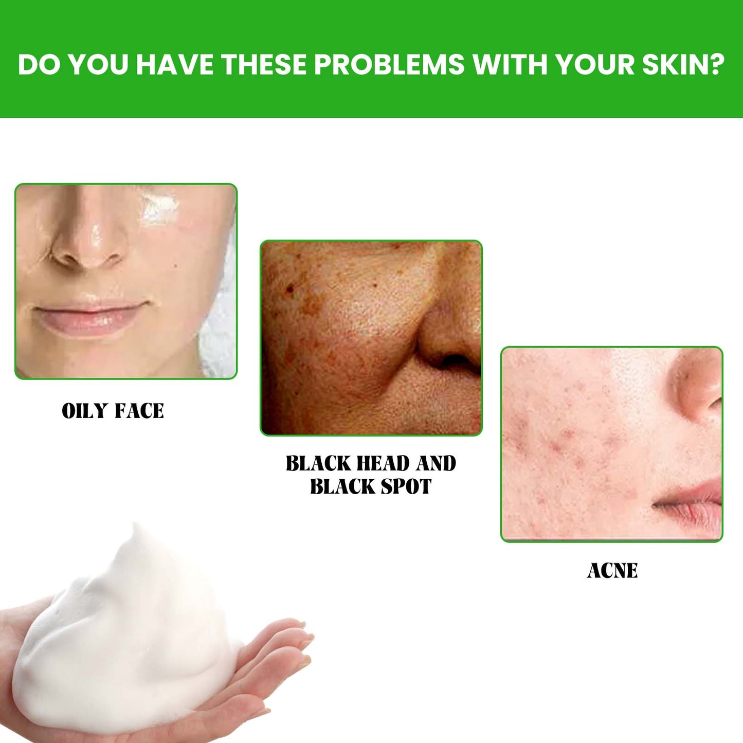 Anti-Acne Facial Cleanser - Deep Pore Cleansing Wash with Hyaluronic Acid