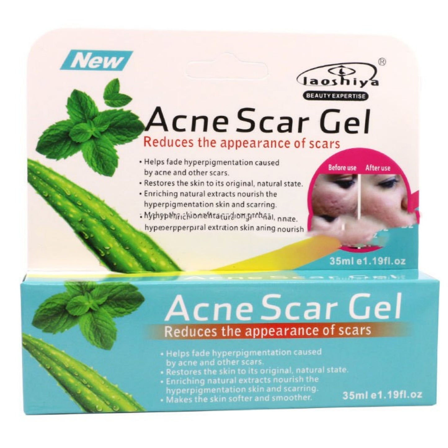 Acne Removal Cream with Green Tea & Aloe Vera 35ml - Oil Control & Pore Tightening