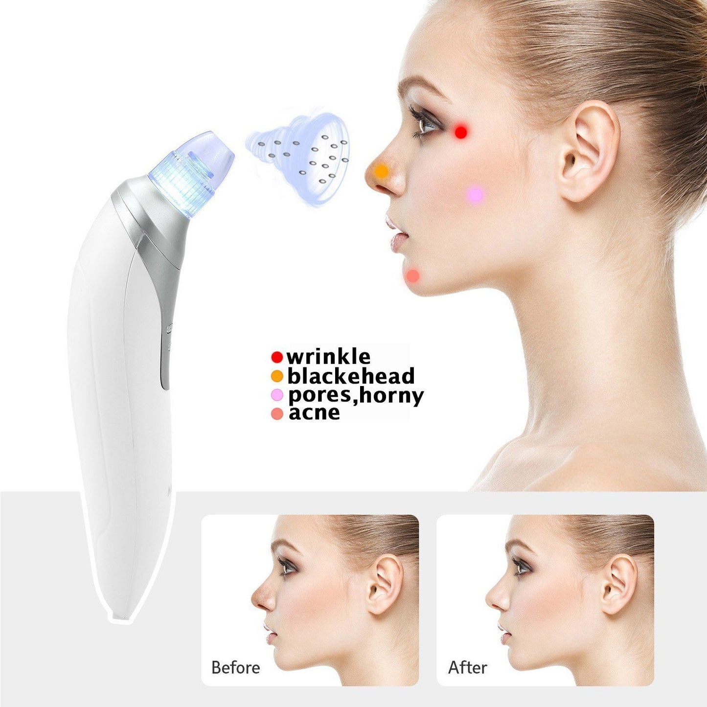 Blackhead Remover - Pore Vacuum Facial Cleansing Tool for Acne & Skin Care