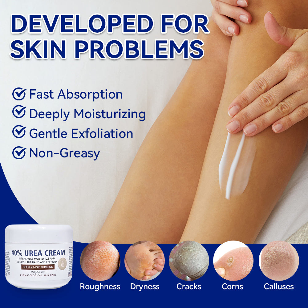 Urea Moisturizing Body Lotion with Vitamin E for Dry Hands and Feet