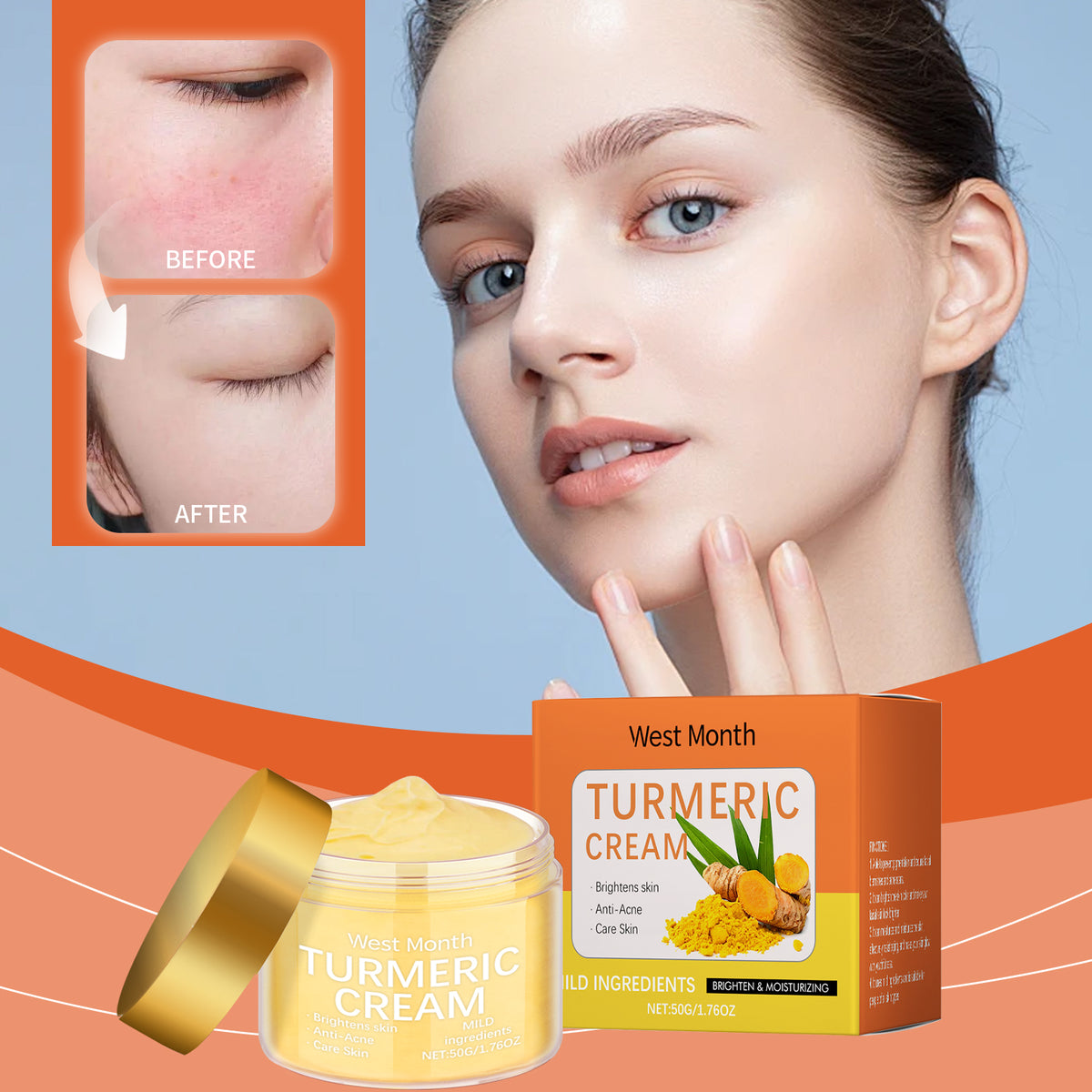 Turmeric Moisturizing Body Cream - Brightens Skin & Fights Acne 50g