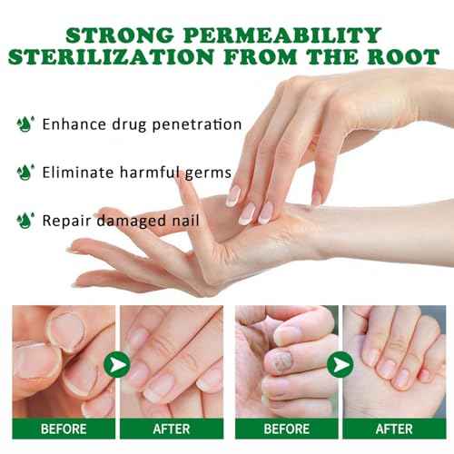 3Pcs Ginger Nail Treatment, 7days Nail Growth Serum Solution, Ginger Cuticle Care Oil for Nails Strengthener, Promote Nail Healthy Grow(30ml)