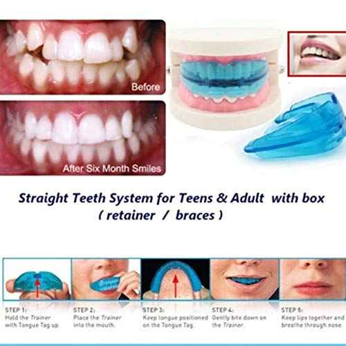 Dental Mouth Guard Bruxism Nighttime Sleep Mouth Grinding Anti Grinding Teeth Protector for Starters