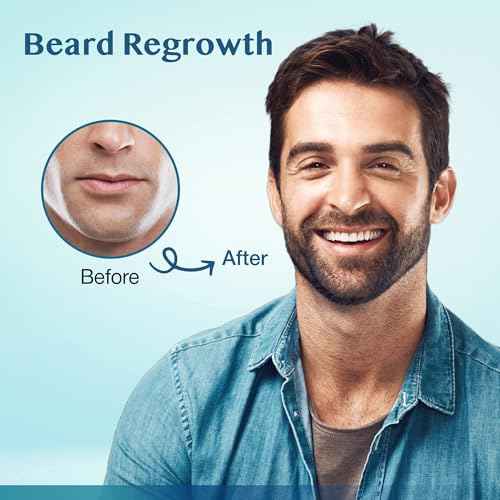 5% Minoxidil Hair Growth for Men and Women: Extra Strength Beard Regrowth Treatment Serum with Minoxidil and Biotin for Thinning Hair Loss to Grow Thicker Fuller 60ml 3 Bottles
