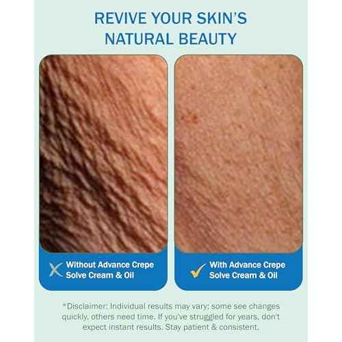 Crepe Skin Erase Cream & Firming Oil Set (2 Pk, 4 Fl Oz each) - with Natural Oils, Licorice Root & Chamomile Extract - Crepey Skin Tightening and Firming Body Cream & Oil, Made in USA