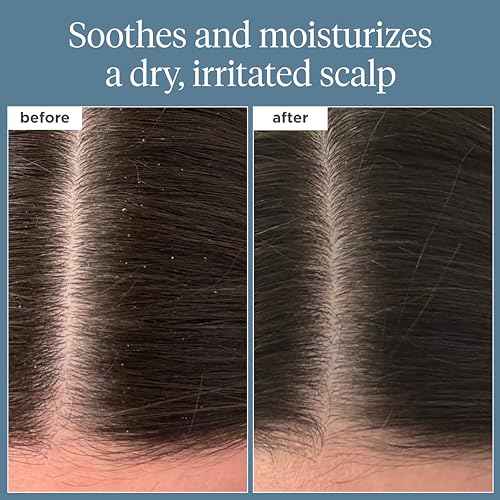 Briogeo Scalp Revival Rosemary Pre-Wash Oil, Hair and Scalp, Dry Scalp Treatment for Stronger and Longer Hair, Soothe Dry Scalp, Lipids and Vitamins, Deep Moisture, Vegan, Cruelty-Free