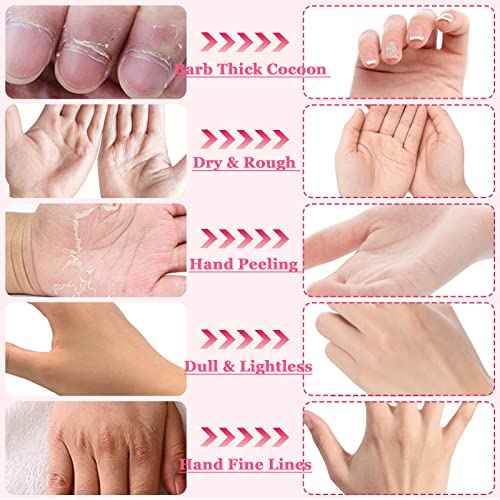 6 Pack Moisturizing Hand Peel Mask Gloves, Hand Mask Natural Collagen Spa Gloves Moisture Enhancing Gloves for Dry Hands, Repair Rough Damage Skin for Women & Men (Rose)