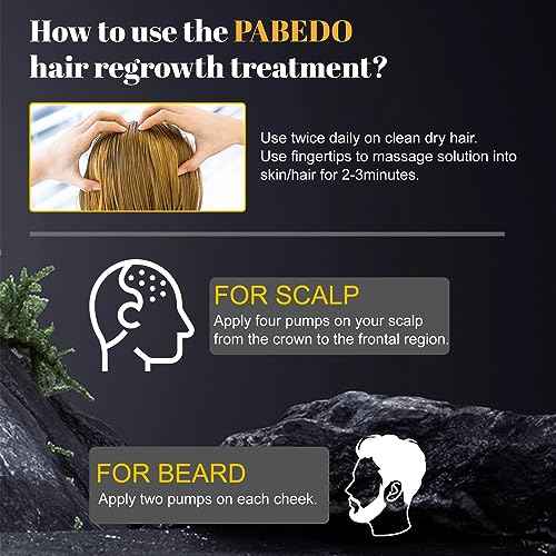 5% Minoxidil Hair Growth Serum, Minoxidil Spray For Beard Growth Serum, Hair Growth oil Spray, Treating Hair Loss For Thicker Longer Fuller Healthier Hair, 3.38 Oz