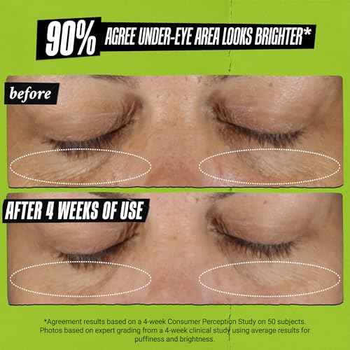 Kiehl's Avocado Eye Treatment, Nourishing and Hydrating Eye Cream, Avocado Oil and Caffeine to Energize and Invigorate Skin, Tired Eyes, 99% Naturally Derived Formula