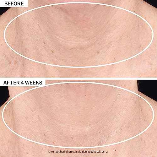 StriVectin TL Advanced™ Light Tightening Neck Cream, 1.7 oz for Tightening and Firming Neck and Décolleté Lines, LIGHT TEXTURE, Reduce Sagging and Crepey Skin