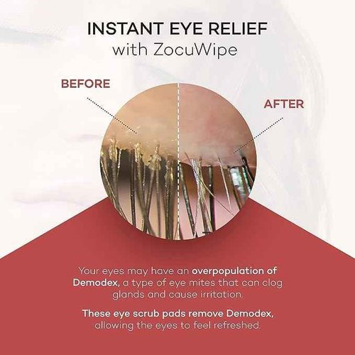 Zocular Zocuwipe Eyelid Wipes Eyelid Cleanser and Moisturizer Pads 30ct + Zocular ZocuZap Facial Wipes, 15 Count Bundle