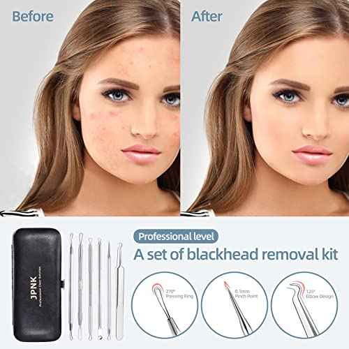 JPNK Blackhead Remover Comedone Extractor Acne Removal Kit..