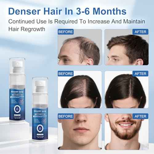 5% Minoxidil for Men and Women, Regrowth Serum, Extra Strength Spray for Hair Loss, Minoxidil 5 Percent, Thicker Healthier Hair, Beard Growth Kit, Topical Treatment, 60ml x 7 Bottles£¨Extra Strength£©