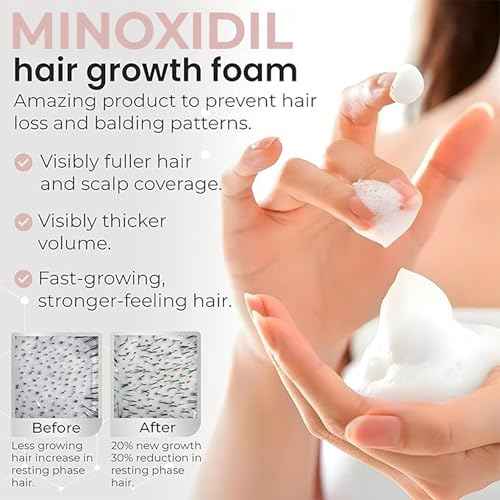 Minoxidil for Women | 5% Minoxidil For Women Hair Growth | Hair Regrowth Treatment | Unscented Topical Foam | Dermatologist Recommended | Clinically Proven Formula | 3 Month Supply