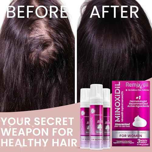 Minoxidil for Women | 5% Minoxidil For Women Hair Growth | Hair Regrowth Treatment | Unscented Topical Foam | Dermatologist Recommended | Clinically Proven Formula | 3 Month Supply