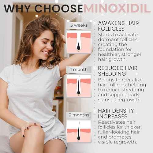Minoxidil for Women | 5% Minoxidil For Women Hair Growth | Hair Regrowth Treatment | Unscented Topical Foam | Dermatologist Recommended | Clinically Proven Formula | 3 Month Supply