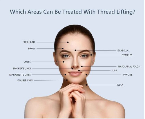 UUP ACE PDO Threads Lift for Face and Body, 360° 6D Cog Thread, Bidirectional Cog/L-Type Blunt (20 pcs) – Skin Lifting & Collagen Boosting, Made in Korea (19G100mm)