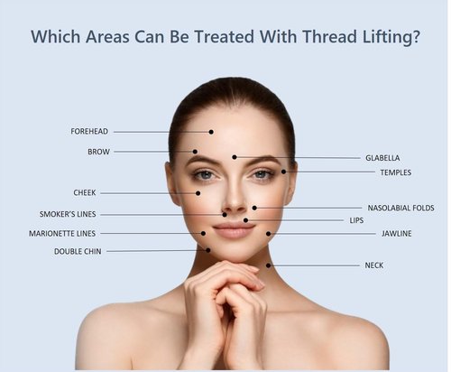 ACE PDO Threads Lift/Made in KOREA - Multi Thread Type/L-Type Blunt for Face Lift (16pcs) (23G38mm), Blue