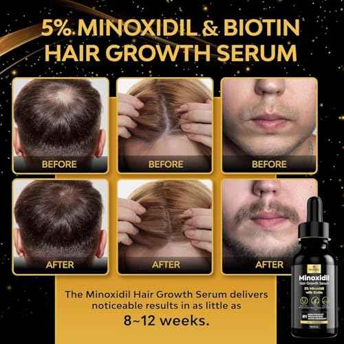 5% Minoxidil Hair Growth for Men and Women: Extra Strength Minoxidil Beard Regrowth Treatment Serum with Biotin for Thinning Hair Loss to Grow Thicker Fuller 30ml 2 Bottles