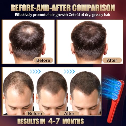 Laser Hair Growth Comb£¬Red Light Hair Growth Treatment for Men & Women£¨Red 1pcs £©