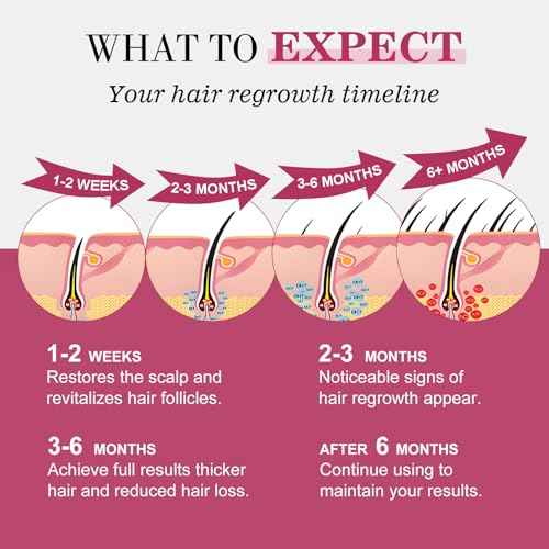 5% Minoxidil for Women Hair Regrowth Spray, hers hair regrowth treatment Infused with Biotin, Extra Strength Treatment to Combat Hair Loss and Thinning, 3 Bottles