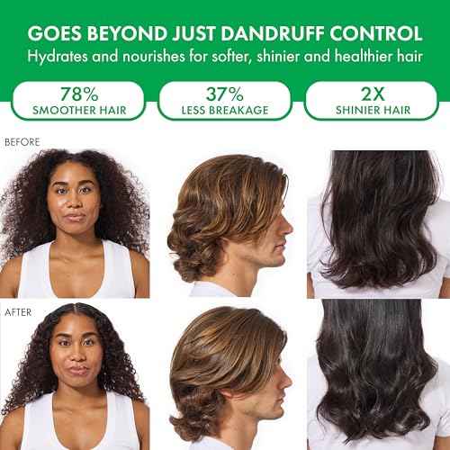 Dercos Selenium Sulfide Anti Dandruff Shampoo, Dry Scalp Treatment and Itch Relief. Prescription Strength Comparable to 2% Ketoconazole, for Mild to Severe Dandruff-Prone Hair & Flaky, Itchy Scalps