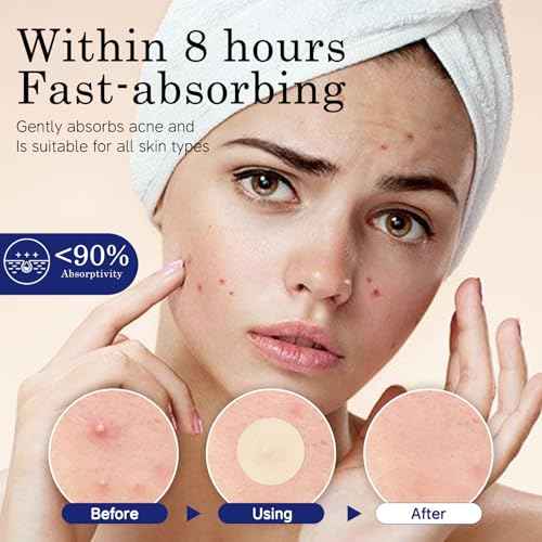 invisible pimple patches for face - acne patches, zit patches, Spot Stickers with Tea Tree and Salicylic Acid£¬4 Sizes (8mm, 10mm, 12mm & 14mm)£¬220 Count