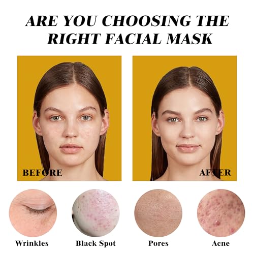 Clay Mask Set (10 Pods) Gold Eye Patches (20 Pairs), Mud Mask Deep Pore Cleansing Acne Blackhead Removal, Eye Patches for Puffy Eyes Dark Circles, Men & Women Facial Mask Eye Masks Skin Care.