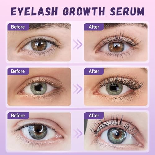 Lash Serum: Eyelash Growth Serum Gentle Natural Vegan Enhancing Treatment Nourishing Conditioning Formula for Longer Thicker Fuller Natural Lashes -5ml
