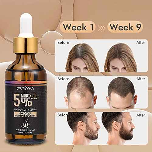 5% Minoxidil Hair Growth Serum for Men and Women, Hair Growth Serum Oil for Hair Loss for Women, Safest Hair Growth Minoxidil Treatment for Boosting Follicles, Hair Regrowth Treatments