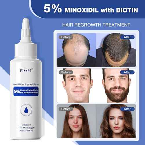 5% Minoxidil for Men, for Men & Women Hair with Biotin, Minoxidil for Beard Growth for Hair Loss to Hair Regrowth Get Thicker Fuller, Hair Loss Treatments for Women 100ml