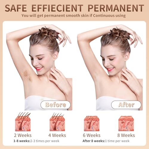 IPL Hair Removal Device for Women and Men,Painless Home Use IPL Beauty Device For Home Use, For Underarm facial hair below the chin line and legs.(Candy Pink/White, 199 * 76.5 * 46.5mm)