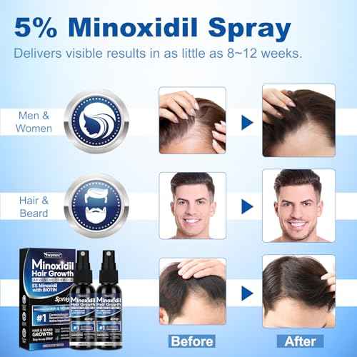 5% Minoxidil Spray 2PCS, Minoxidil for Women Hair Growth, Minoxidil for Men Hair and Beard, Minoxidil Spray for Men and Women.