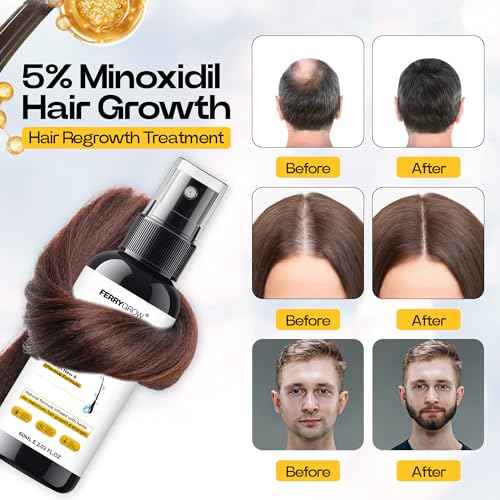 5% Minioxidil Hair Growth Serum for Men with Biotin Regrowth Hair Treatment For Thickens Hair Promotes Hair Density Help to Stop Thinning loss Hair stimulates Hair Growth