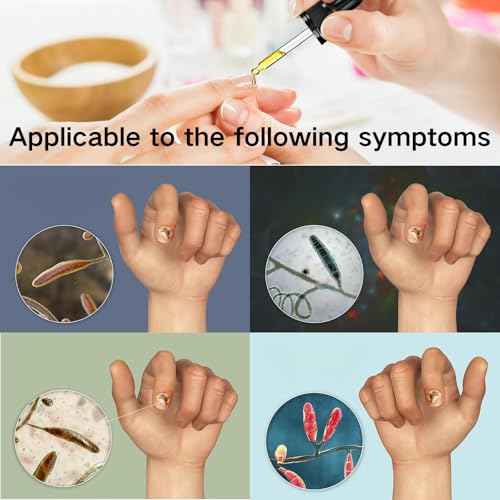 Ginger Nail Treatment, Ginger Cuticle Care Oil for Nails (2 PCS)