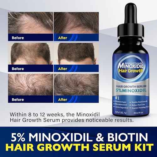 ANAREAL Minoxidil for Men and Women, 5% Minoxidil for Men Beard Growth enriched with Biotin, Minoxidil for Women Hair Growth, Minoxidil Beard Growth Oil, Beard Growth Serum