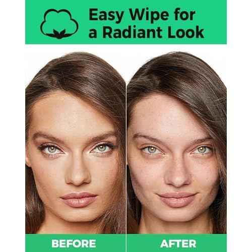 ProCIV Reusable Makeup Remover Pads - 25 Pack Washable Organic Cotton Rounds for All Skin Types & Toner with Laundry Bag, Eco Friendly Zero Waste Reusable Cotton Pads Travel Gadgets (Black)