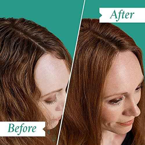 PHILIP KINGSLEY | Moisture Balancing Combination Shampoo | Hydrating for Dry and/or Oily Hair | Anti-Frizz, Antioxidant Shampoo that Hydrates and Adds Shine | 33.8oz