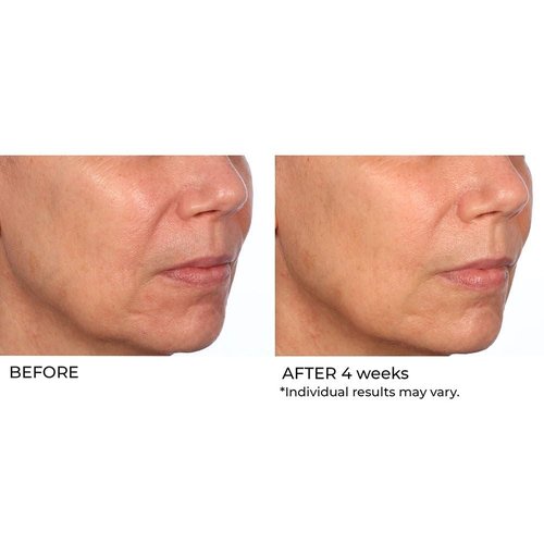 NassifMD Hydro-Gel with Hylauronic Acid Moisturizer, Salicylic Acid Serum, Retinol Serum for Face