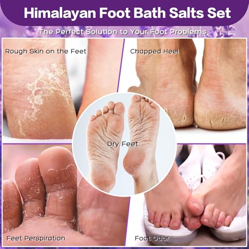 Foot Soak Salts 4 Pack Kit 56 OZ Himalayan Pink Salt Lavender Orange Rose Scent Athletes Itching,Tea Tree Oil Foot Care Pedicure for Women Dead Sea Salt Moisturizing Skin Softens Calluses