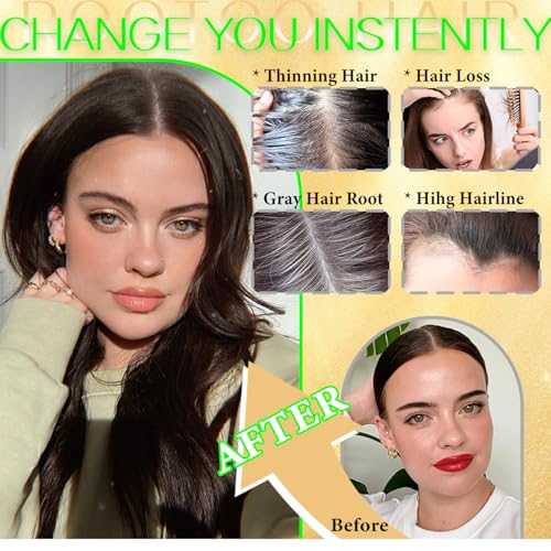 Rootoo Hair Toppers for Women Real Human Hair, 18 Inch Realistic Biological Scalp Topper Hair Pieces for Women with Thinning Crown with Middle Part Clip in Bangs Big Base 360¡Æ Cover (Black)