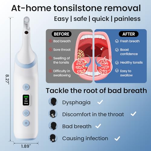 Tonsil Stone Remover with Camera, Electronic Tonsil Stone Removal Kit with LED Light,3 Suction Levels,Fight Bad Breath,Tonsil Stone Vacuum,USB Rechargeable