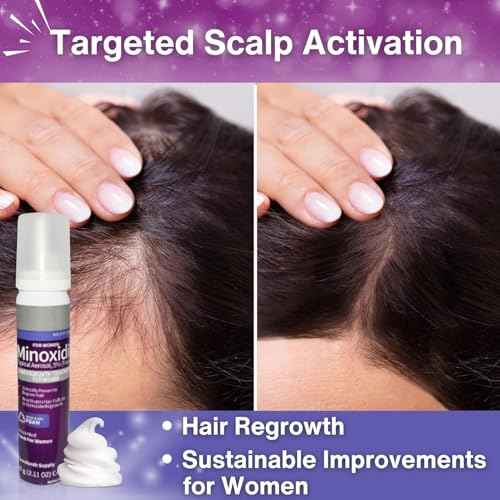 Minoxidil 5% Hair Growth Foam for Women | Unscented Once-A-Day Treatment for Thicker, Fuller Hair | Clinically Proven, Regrowth Solution for Thinning Hair | 2-Month Supply | Perrigo & Kirkland& Costco