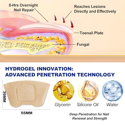Nail TreatmentFungal Nail Patches For Toenails 32patches, Restore The Nails¡¯ Natural Strength And Clarity.