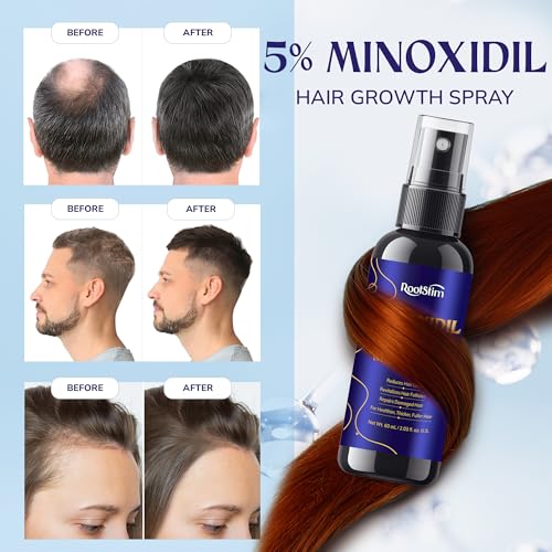 5% Minoxidil Hair Growth for Men and Women: 2-Pack Extra Strength Minoxidil Hair Loss Treatment Serum with Rosemary for Faster Stronger Thicker Hair Growth - 60ML Each