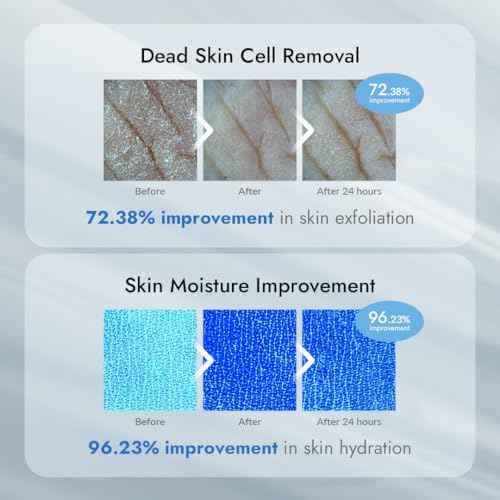 V11FACTORY AHA 12% Glycolic Acid Body Lotion ? Korean Exfoliating & Hydrating Body Cream with Hyaluronic Acid & Collagen ? Unscented, Paraben-Free Skin Smoothing Moisturizer, 10.6 oz