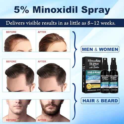 5% Minoxidil for Men Hair, Minoxidil for Women Hair Growth, Minoxidil 5 Percent Hair Regrowth for Men, Minoxidil Spray for Hair and Beard Growth 2PCS