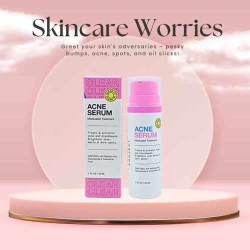 iNNBEAUTY PROJECT Acne Serum Medicated Treatment for Acne & Blackheads 1 oz / 30 ml