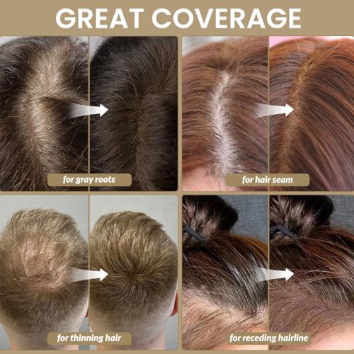 VOLLUCK Root Touch up Powder, Instant Hairline Powder for Thinning Areas and Gray Hair Coverage, Natural and Non-greasy Root Cover up for Women and Men (Dark Brown, 0.14 Ounce)