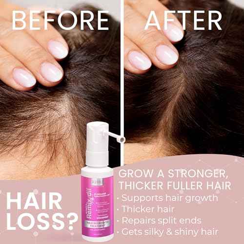 2% Minoxidil for Women Hair Regrowth Spray? Minoxidil Thicker & Fuller Topical Solution for Hair Loss Treatment, Follicle Reactivation, Clinically Proven Formula - 60 ml